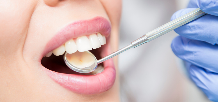 implante dental cuidados dentista