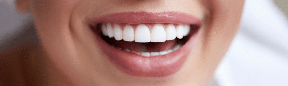 estetica dental madrid