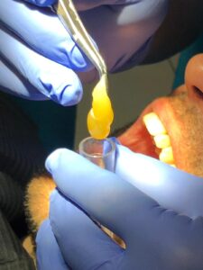 Plasma rico en plaquetas en odontología