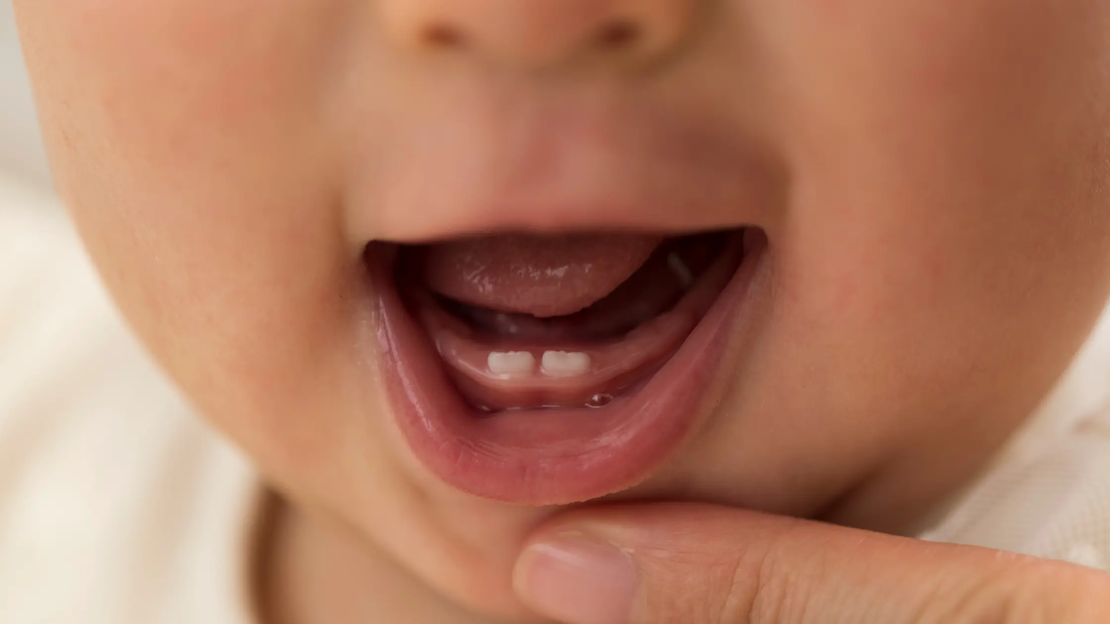 Primeros dientes de leche en un bebé en etapa de dentición, atención odontopediátrica en Madrid - OHI