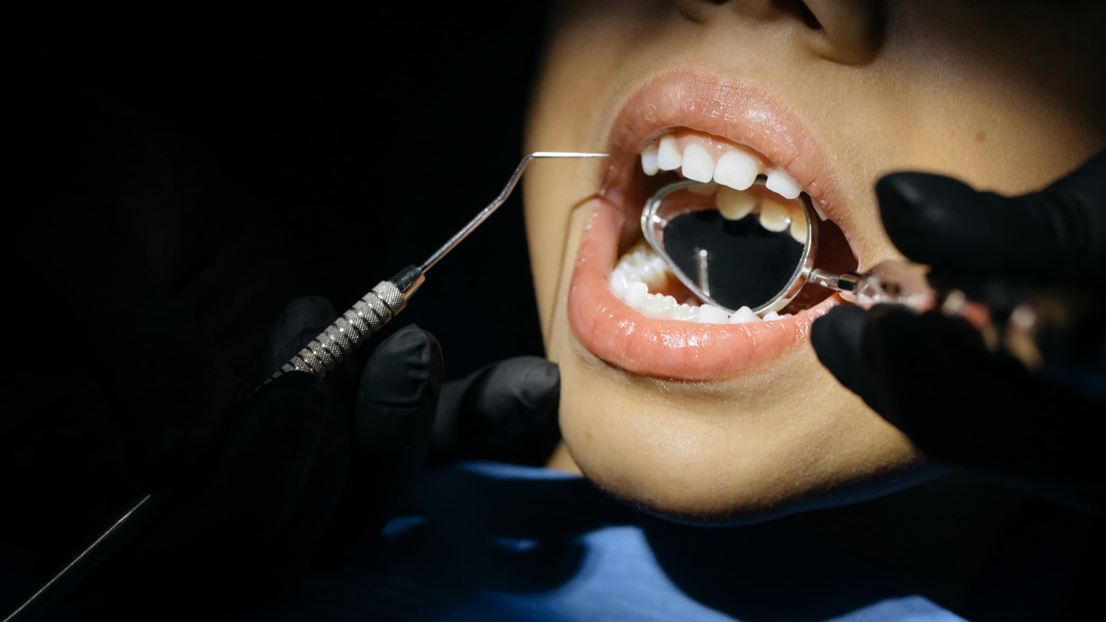 Revisión dental en Carabanchel