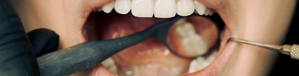Periodoncia y salud de las encías en Carabanchel Periodoncia en Carabanchel