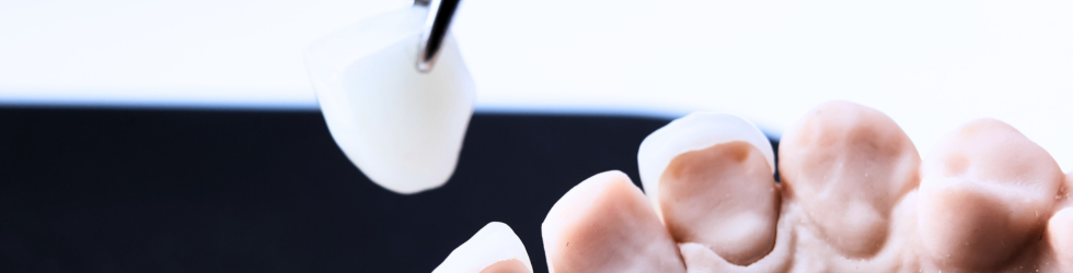 Lámina ultrafina de porcelana siendo colocada sobre un modelo dental para comprobar el ajuste y la estética