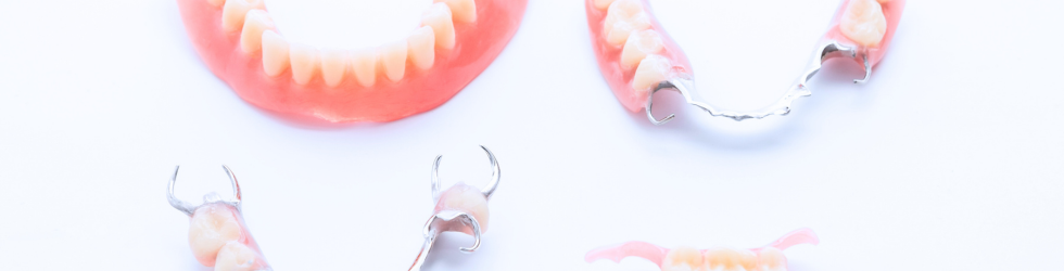Muestrario de prótesis dentales removibles tradicionales de resina y metal en una clínica dental de Vallecas