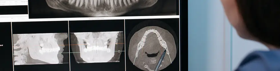 ¿Cuánto cuesta la ortodoncia invisible en Carabanchel? Precios y qué incluye el tratamiento? ¿Cuánto cuesta la ortodoncia invisible en Carabanchel? Precios y qué incluye el tratamiento?