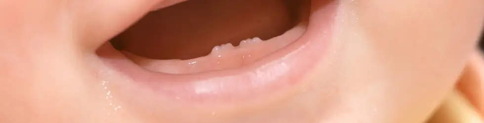 Primer diente de leche bebe primera visita dentista infantil Vallecas
