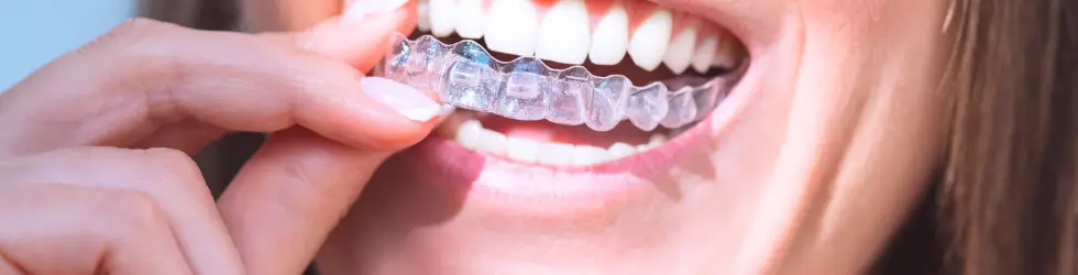 ¿Precio de un implante dental en Carabanchel? ¿Cuánto cuesta? Paciente colocándose un alineador transparente de ortodoncia invisible en Vallecas