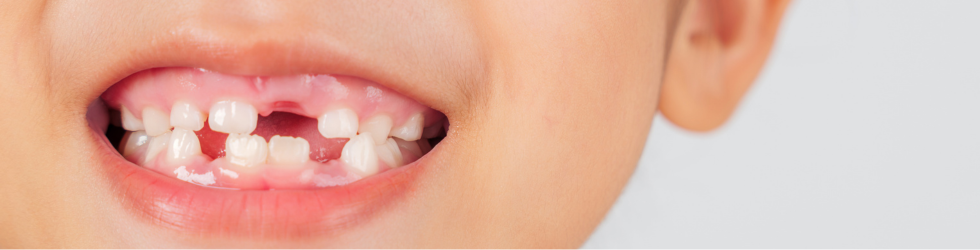 golpe-en-los-dientes-en-ninos
