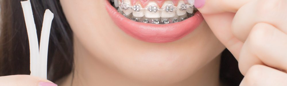 cera-dental-copu
