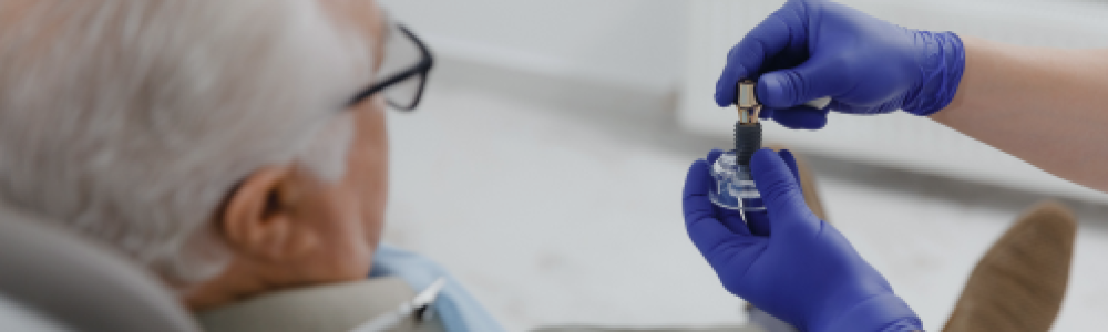 duracion-implante-dental
