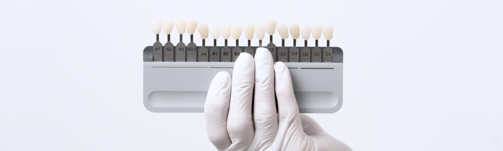 Blanqueamiento dental con muestrario de tonos de esmlate