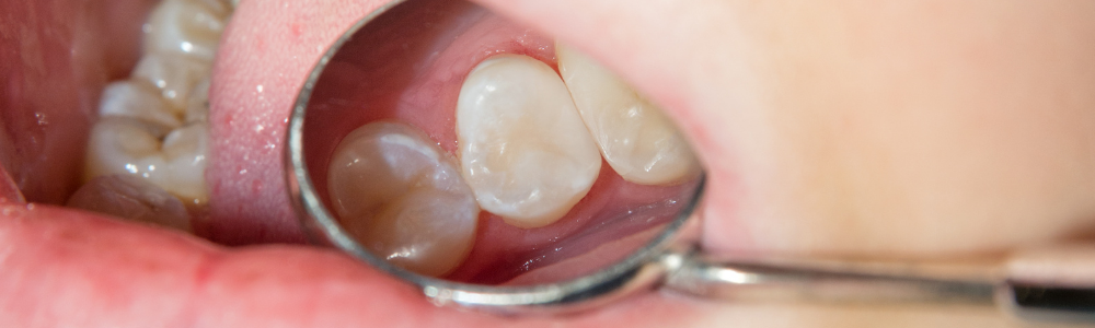 nueva imagen cabecera dolor-de-dientes (1)